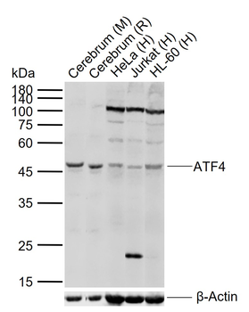 ATF4 antibody