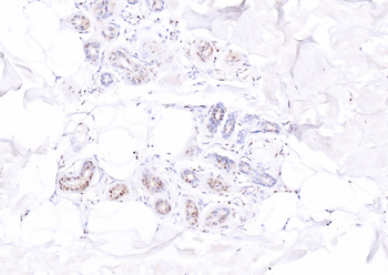 ATF4 antibody