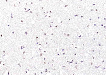 ATF4 antibody