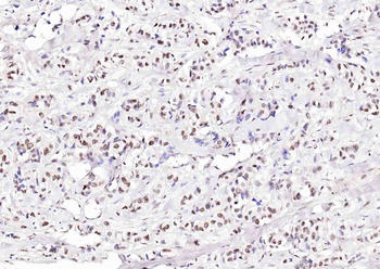 ATF4 antibody