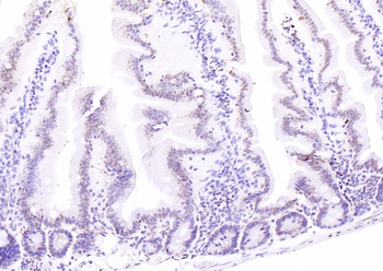 ATF4 antibody