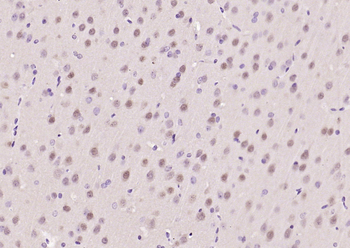 ATF6 antibody