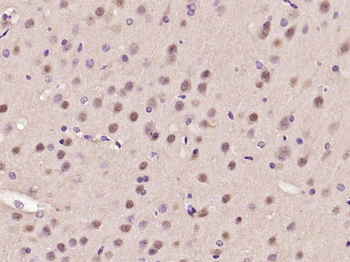 ATF6 antibody