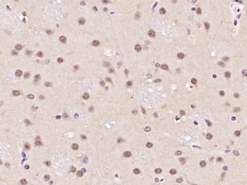 ATF6 antibody