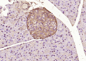 ATF6 antibody