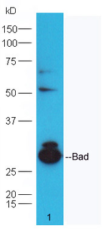 Bad antibody