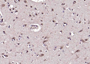 NARG2 antibody