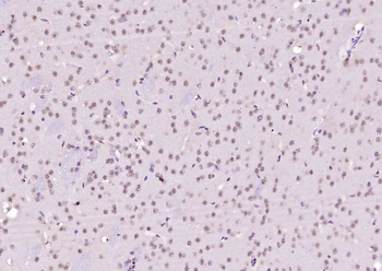 NARG2 antibody