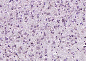 NARG2 antibody