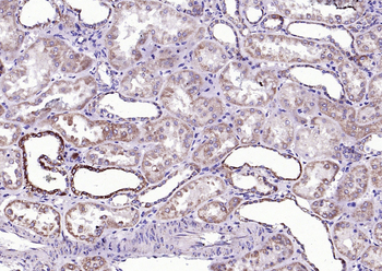 BAD (phospho-Ser128) antibody