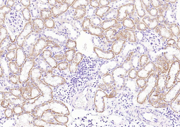 BAD (phospho-Ser128) antibody