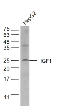 IGF I antibody