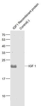 IGF I antibody