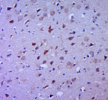 IL1 beta antibody