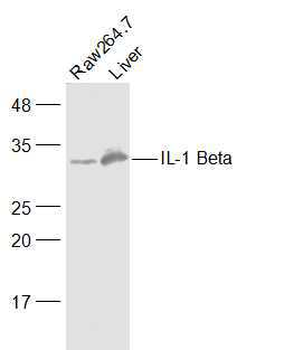 IL1 beta antibody