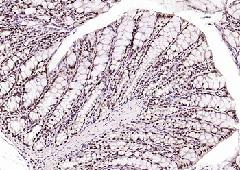 BRD7 antibody