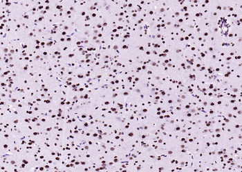 BRD7 antibody