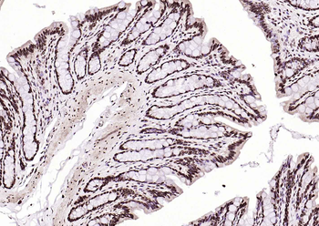 BRD7 antibody