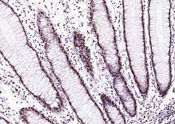 BRD7 antibody