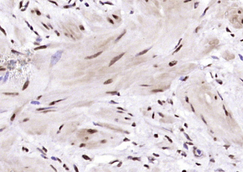 BRD7 antibody