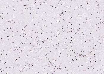 BRD7 antibody