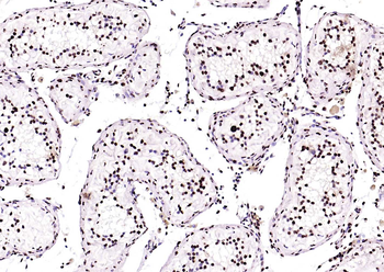 BRD7 antibody