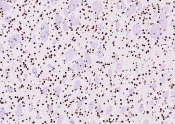 BRD7 antibody