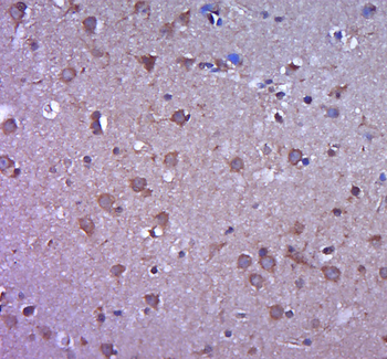 MMP-2 antibody