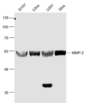 MMP-2 antibody