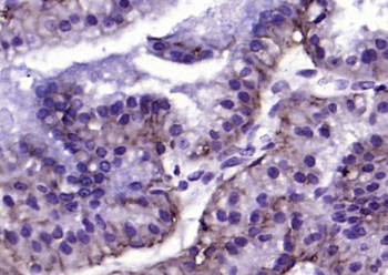 EpCAM antibody