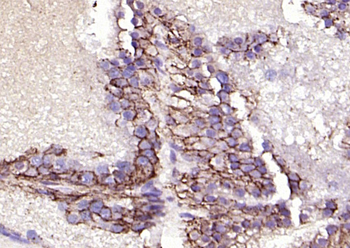 EpCAM antibody