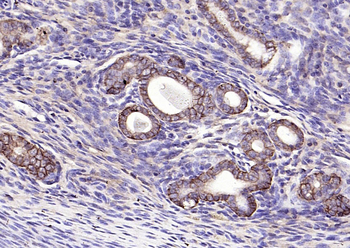 EpCAM antibody