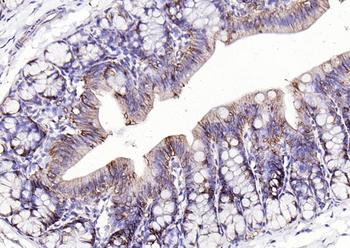 EpCAM antibody