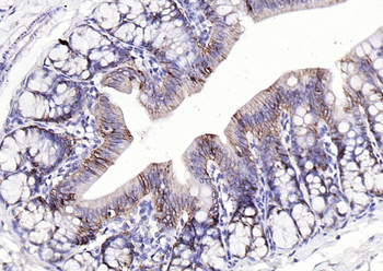 EpCAM antibody