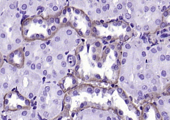 EpCAM antibody