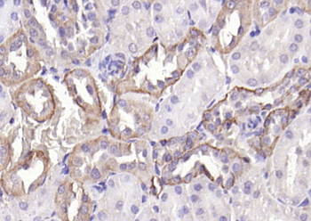 EpCAM antibody