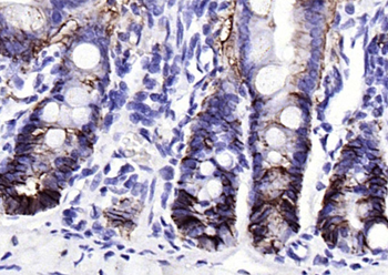 EpCAM antibody