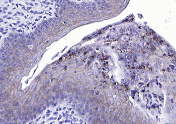 EpCAM antibody