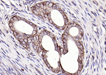 EpCAM antibody