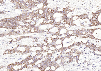 EpCAM antibody