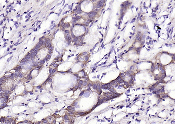 EpCAM antibody