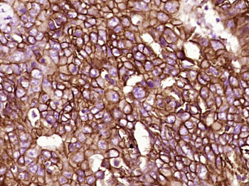 EpCAM antibody