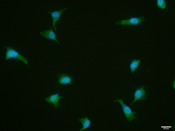 M2-PK antibody