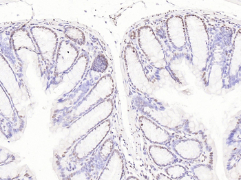 CDK1 antibody