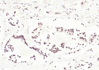 CDK4 antibody