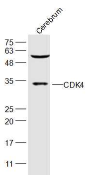 CDK4 antibody