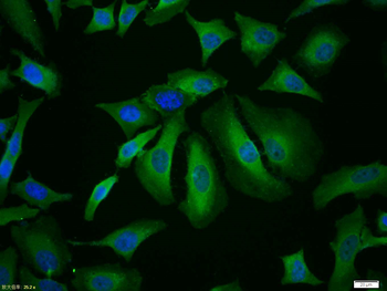 CDK4 antibody