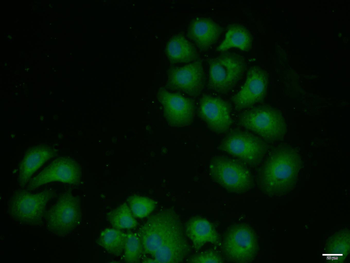 CDK7 antibody