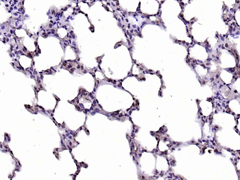 CDK7 antibody