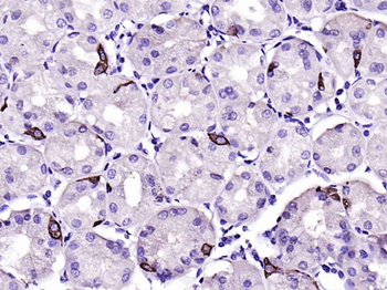 Chromogranin A antibody